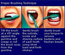 brush technique